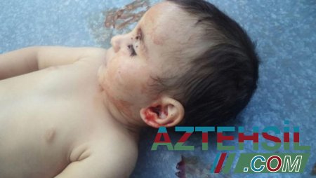 Азербайджанским детям, погибшим в результате атак армян, посвятили песню – АУДИО